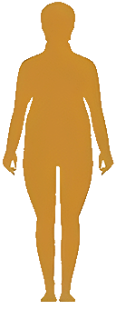 BMI国际WHO标准1类肥胖（肥胖）范围30.0 ~ 34.9